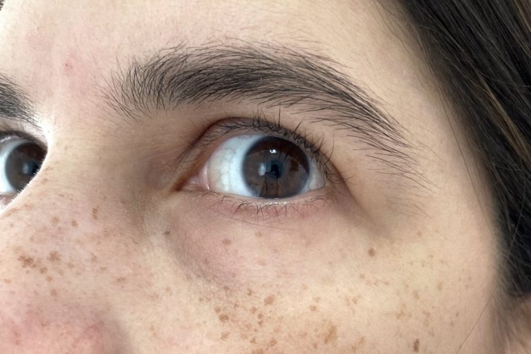 Beauty Industry’s Anti-Freckle Products Face Growing Consumer Backlash